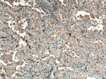 WFDC12 Antibody in Immunohistochemistry (Paraffin) (IHC (P))