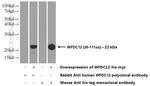 WFDC12 Antibody in Western Blot (WB)