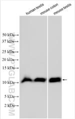 NMES1 Antibody in Western Blot (WB)