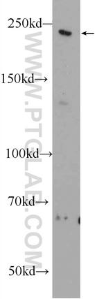 MYO16 Antibody in Western Blot (WB)