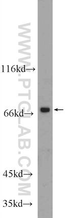 MGAT4A Antibody in Western Blot (WB)