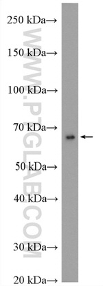 BTNL2 Antibody in Western Blot (WB)