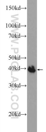 POU3F4 Antibody in Western Blot (WB)