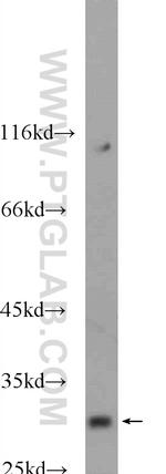 SHOX Antibody in Western Blot (WB)