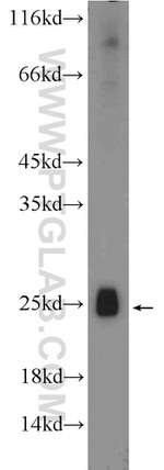 SHOX Antibody in Western Blot (WB)