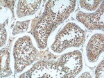 DNAJB13 Antibody in Immunohistochemistry (Paraffin) (IHC (P))