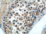 DNAJB13 Antibody in Immunohistochemistry (Paraffin) (IHC (P))
