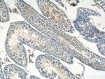 DNAJB13 Antibody in Immunohistochemistry (Paraffin) (IHC (P))