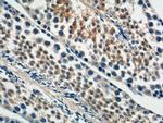 DNAJB13 Antibody in Immunohistochemistry (Paraffin) (IHC (P))