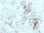 Ferritin, Light Chain (Node-Negative Breast Tumor Prognostic Marker) Monoclonal Antibody (FTL/1387)