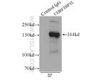 UHRF1BP1L Antibody in Immunoprecipitation (IP)