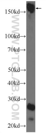 UHRF1BP1L Antibody in Western Blot (WB)