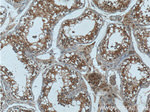 UBAC2 Antibody in Immunohistochemistry (Paraffin) (IHC (P))