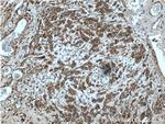UBAC2 Antibody in Immunohistochemistry (Paraffin) (IHC (P))