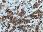 UBAC2 Antibody in Immunohistochemistry (Paraffin) (IHC (P))