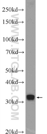 UBAC2 Antibody in Western Blot (WB)