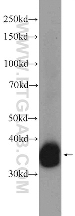UBAC2 Antibody in Western Blot (WB)