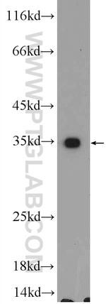UBAC2 Antibody in Western Blot (WB)