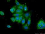 C6orf211 Antibody in Immunocytochemistry (ICC/IF)