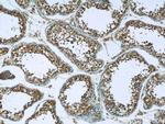 C6orf211 Antibody in Immunohistochemistry (Paraffin) (IHC (P))