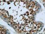 C6orf211 Antibody in Immunohistochemistry (Paraffin) (IHC (P))