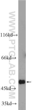 C6orf211 Antibody in Western Blot (WB)