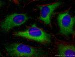 Cleaved Caspase 3 Antibody in Immunocytochemistry (ICC/IF)