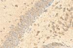 Cleaved Caspase 3 Antibody in Immunohistochemistry (Paraffin) (IHC (P))
