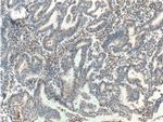 RNF38 Antibody in Immunohistochemistry (Paraffin) (IHC (P))