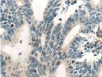 RNF38 Antibody in Immunohistochemistry (Paraffin) (IHC (P))