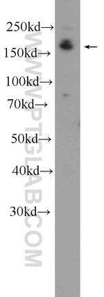 DAPK1 Antibody in Western Blot (WB)