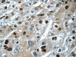 ONECUT1 Antibody in Immunohistochemistry (Paraffin) (IHC (P))