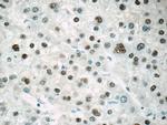 ONECUT1 Antibody in Immunohistochemistry (Paraffin) (IHC (P))