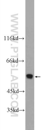 ONECUT1 Antibody in Western Blot (WB)