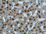 ONECUT1 Antibody in Immunohistochemistry (Paraffin) (IHC (P))
