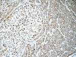 ONECUT1 Antibody in Immunohistochemistry (Paraffin) (IHC (P))