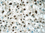 ONECUT1 Antibody in Immunohistochemistry (Paraffin) (IHC (P))