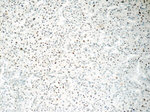ONECUT1 Antibody in Immunohistochemistry (Paraffin) (IHC (P))