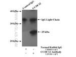 CCDC12 Antibody in Immunoprecipitation (IP)
