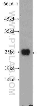 CCDC12 Antibody in Western Blot (WB)