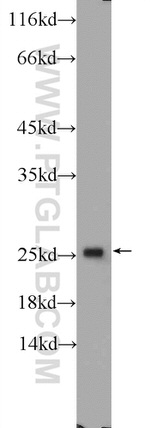CCDC12 Antibody in Western Blot (WB)