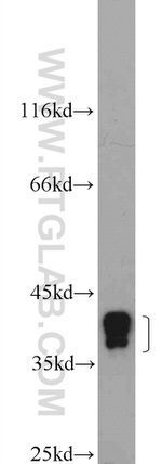HNRNPA3 Antibody in Western Blot (WB)