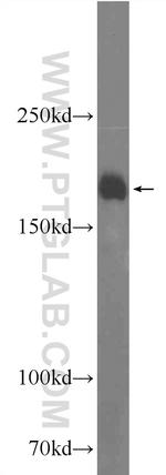 ARAP2 Antibody in Western Blot (WB)