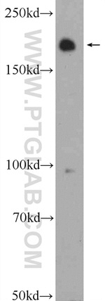 ARAP2 Antibody in Western Blot (WB)