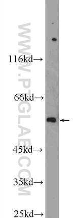 TBX15 Antibody in Western Blot (WB)