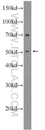 TBX15 Antibody in Western Blot (WB)