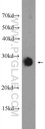 LIN7A Antibody in Western Blot (WB)
