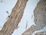 SYNC Antibody in Immunohistochemistry (Paraffin) (IHC (P))