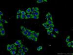 PROSC Antibody in Immunocytochemistry (ICC/IF)