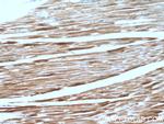 PROSC Antibody in Immunohistochemistry (Paraffin) (IHC (P))